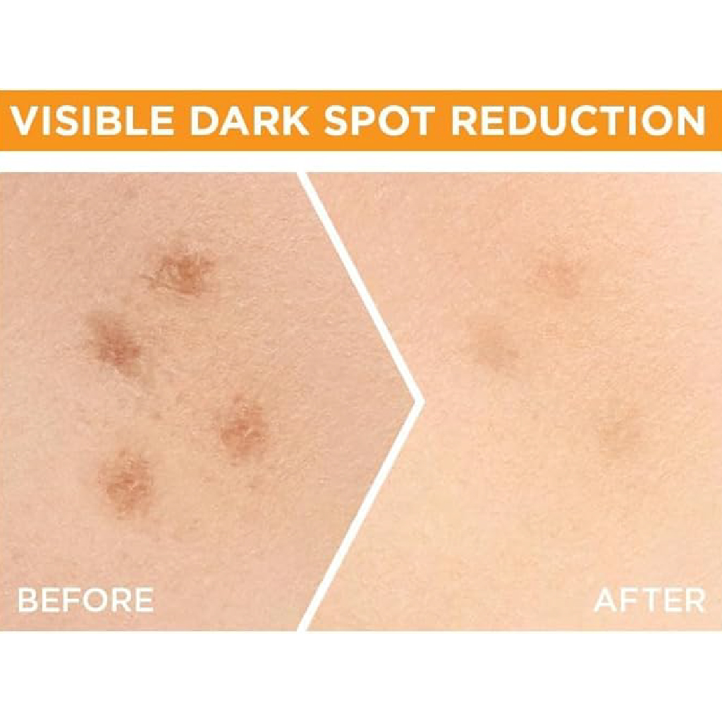 Garnier, Dark Spot Serum, Targeted serum for dark spot correction, 30ml