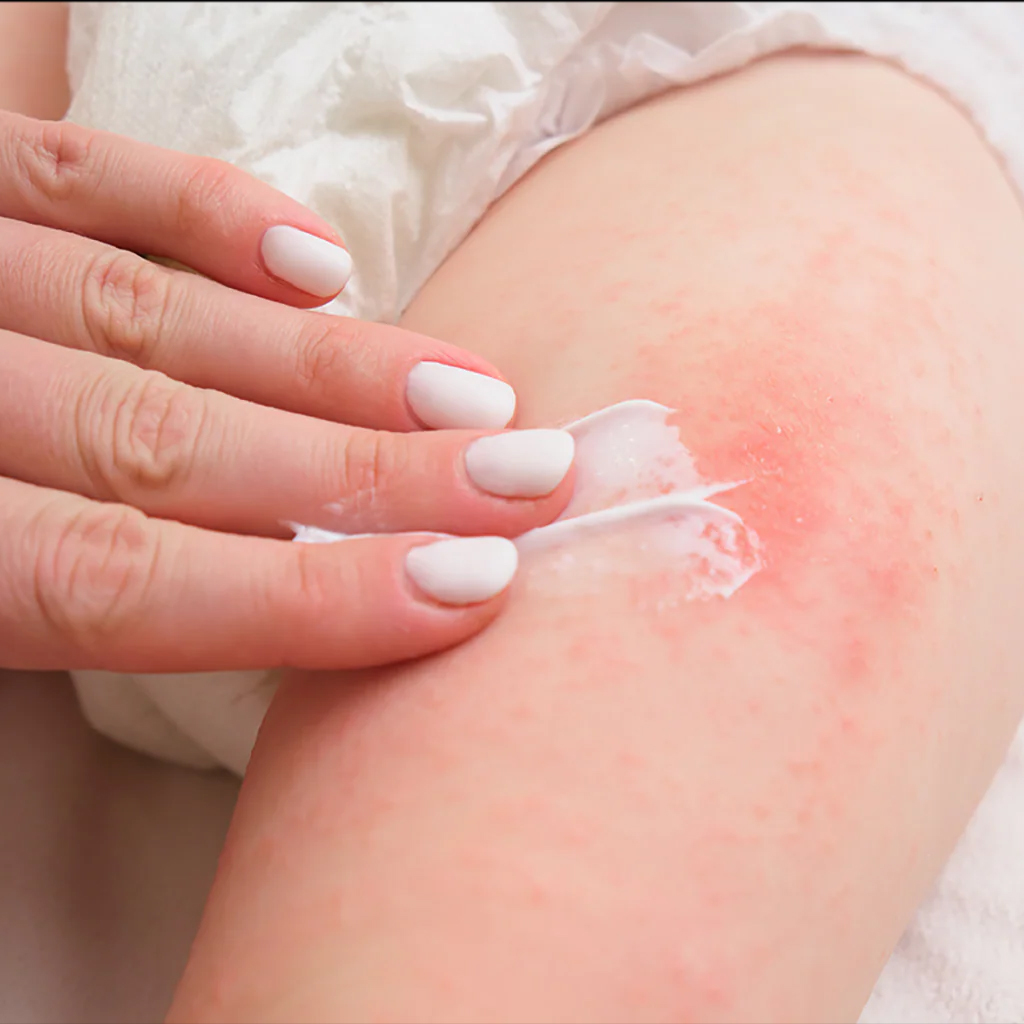 Salonpas Patchs Large 2 Pcs