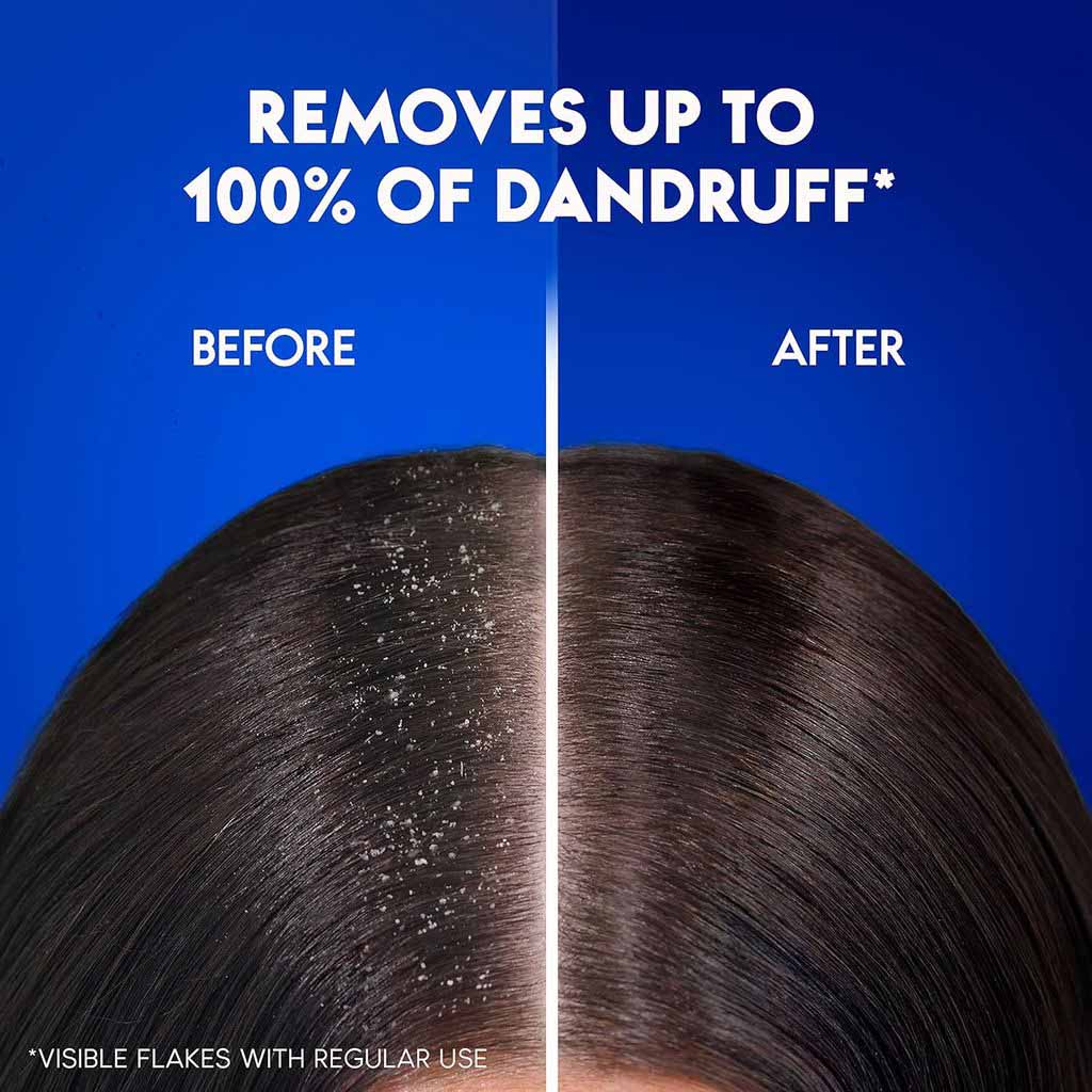 Head & Shoulders, Lovely Silk Shampoo, Nourishing Anti-Dandruff Shampoo with Silk Proteins, 190ml