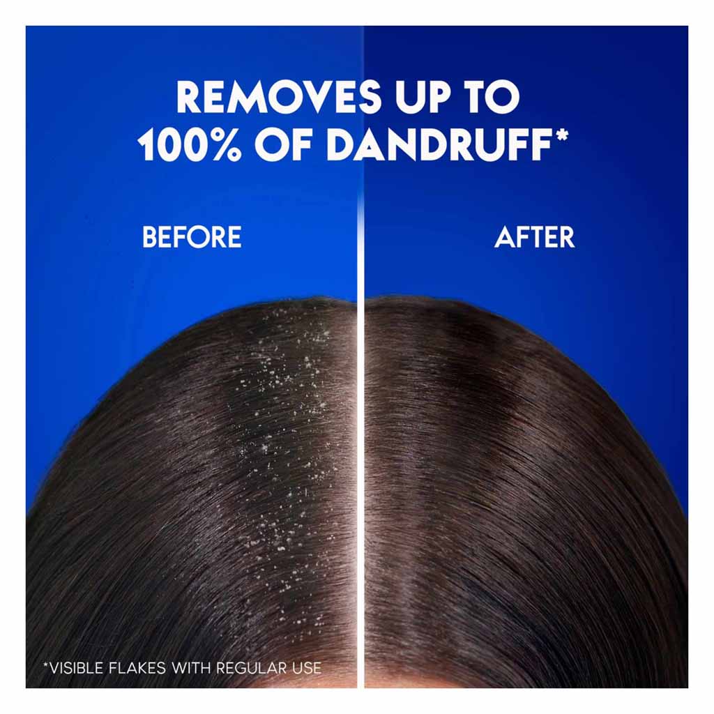 Head & Shoulders Dry Scalp Care Moisturizer Almond Oil Shampoo 190 ml X