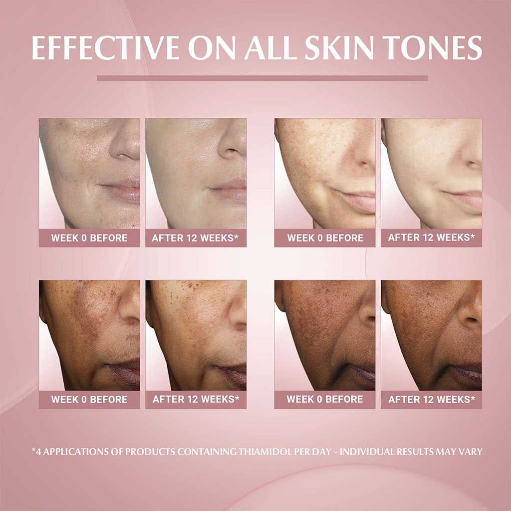 Eucerin Even Pigment Perfector Day 50 ml