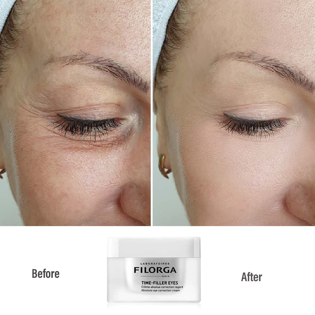 Filorga Time Filler Eyes 15 mL