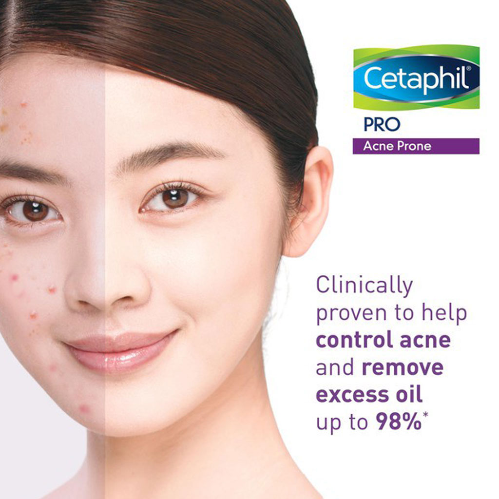 Cetaphil, Pro Acne Prone Skin Foam Wash, Foaming cleanser for acne-prone skin care