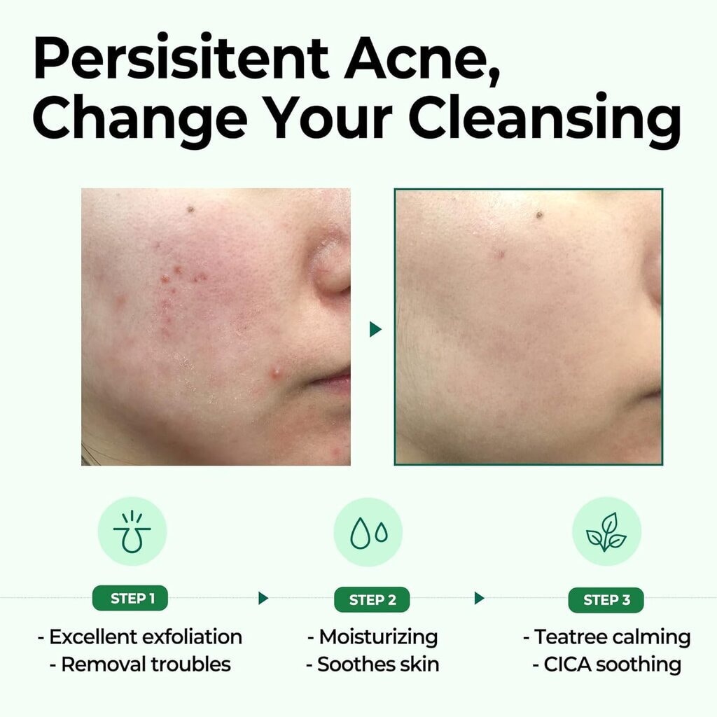 SBM, AHA-BHA-PHA 30 Days Miracle Cleansing Bar, Exfoliating and clarifying facial cleansing bar, 106g