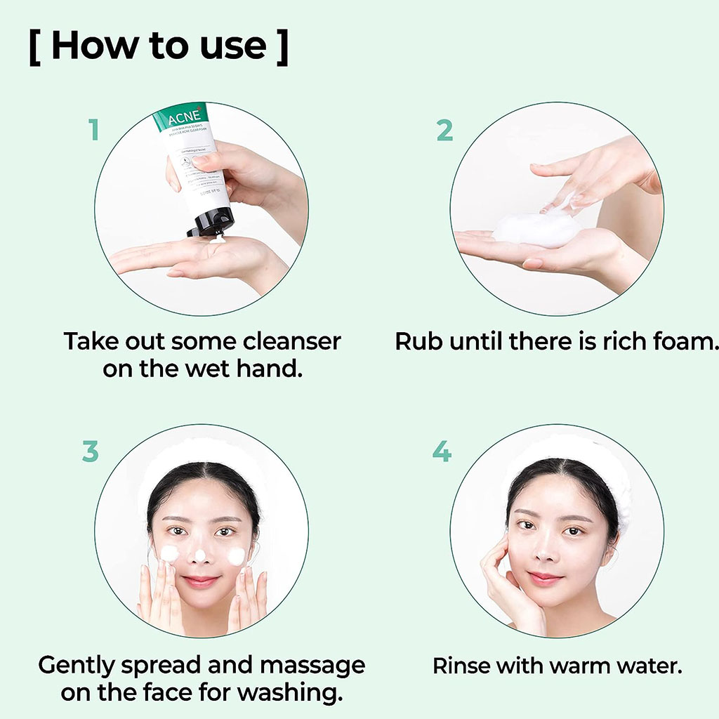 Sbm Aha-Bha-Pha 30Days Miracle Acne Clear Foam 100 ml