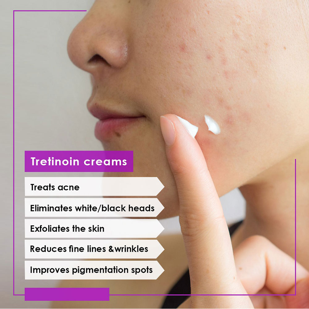 Acretin, 0.50% Cream, Topical retinoid cream for acne treatment and skin renewal, 30 g