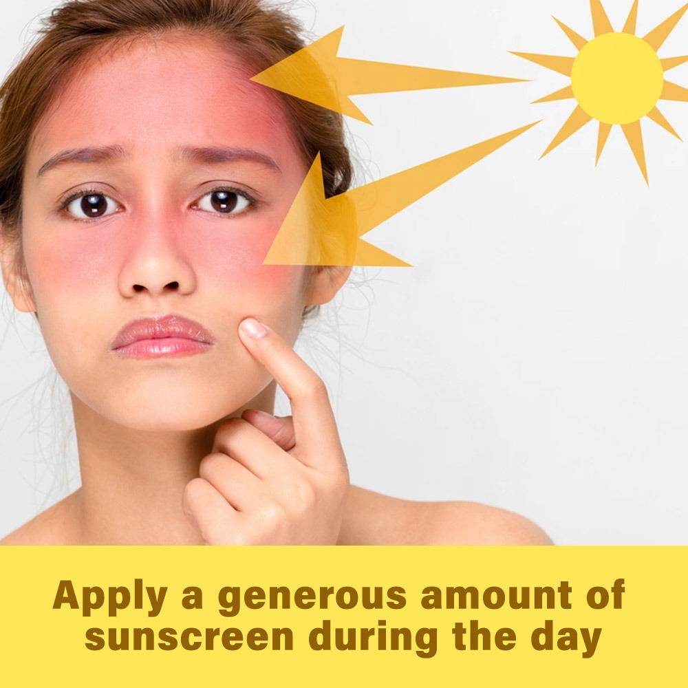 Acretin, 0.50% Cream, Topical retinoid cream for acne treatment and skin renewal, 30 g