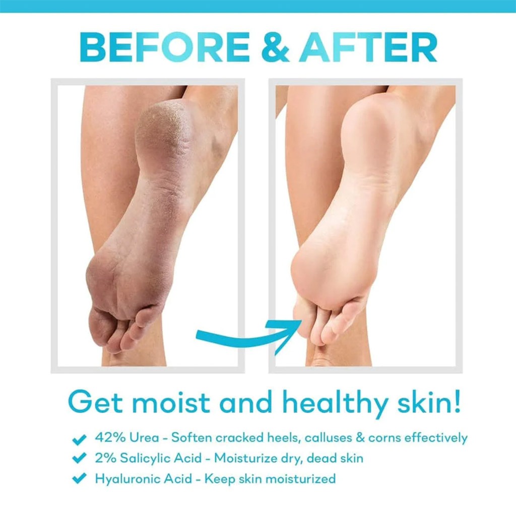 CeraVe, SA Renewing Foot Cream with Salicylic Acid, Exfoliating and moisturizing foot cream for dry, rough skin, 88ml