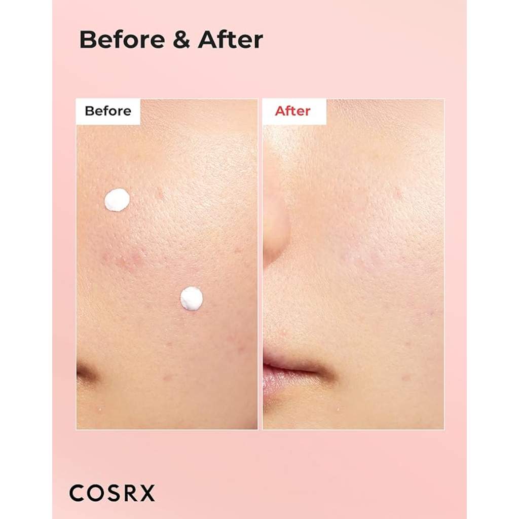 COSRX AC Collection Blemish Spot Drying Lotion 18ml