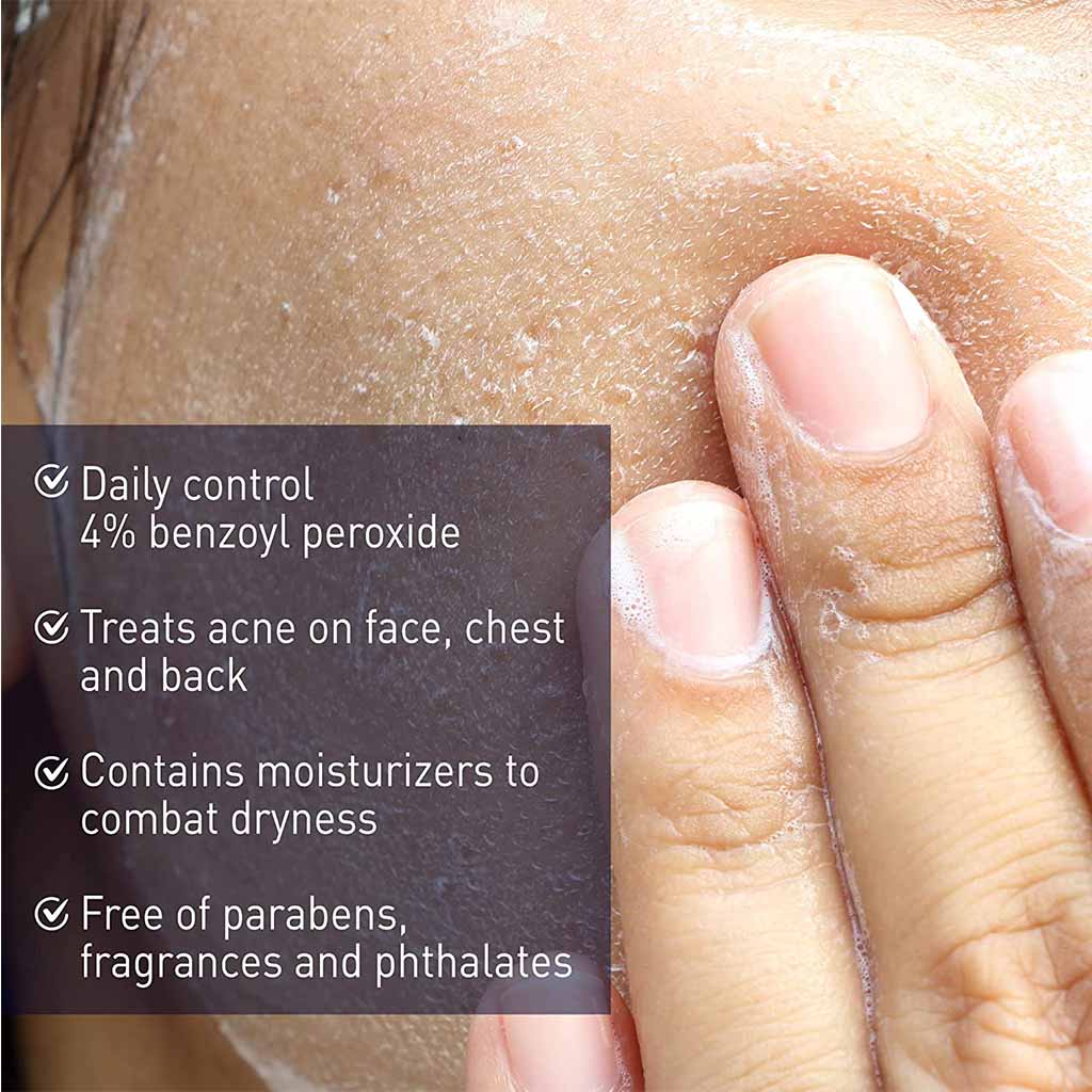 Panoxyl Acne Creamy Wash 4% Benzoyl Peroxide Daily Control - 170 G