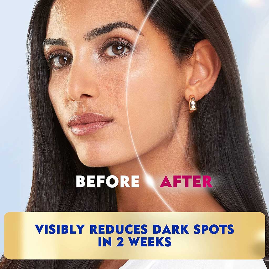 Nivea, Luminous630 Even Glow Concentrated Serum, Brightening serum for even skin tone, 30 ml