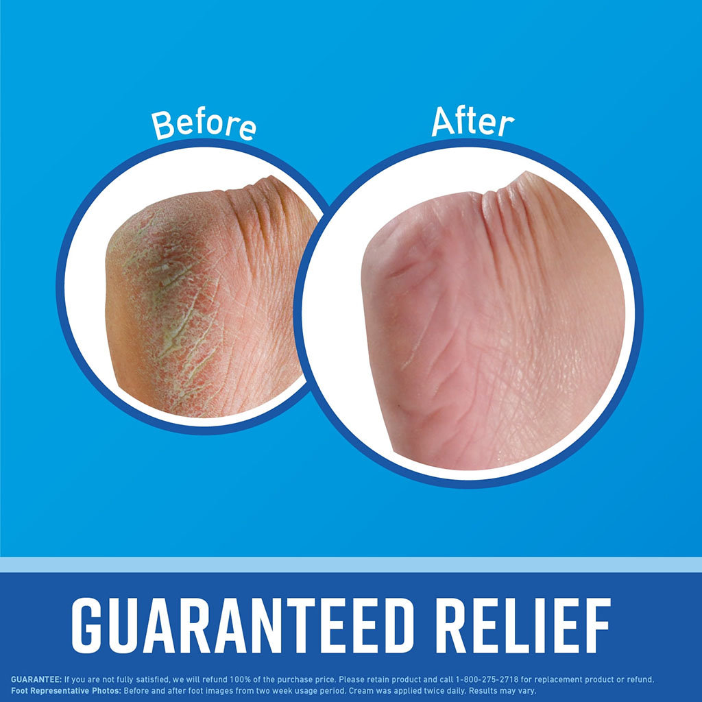 O'Keeffe's, Healthy Feet Foot Cream, Intensive moisturizing foot cream for dry, cracked skin, 89ml tube