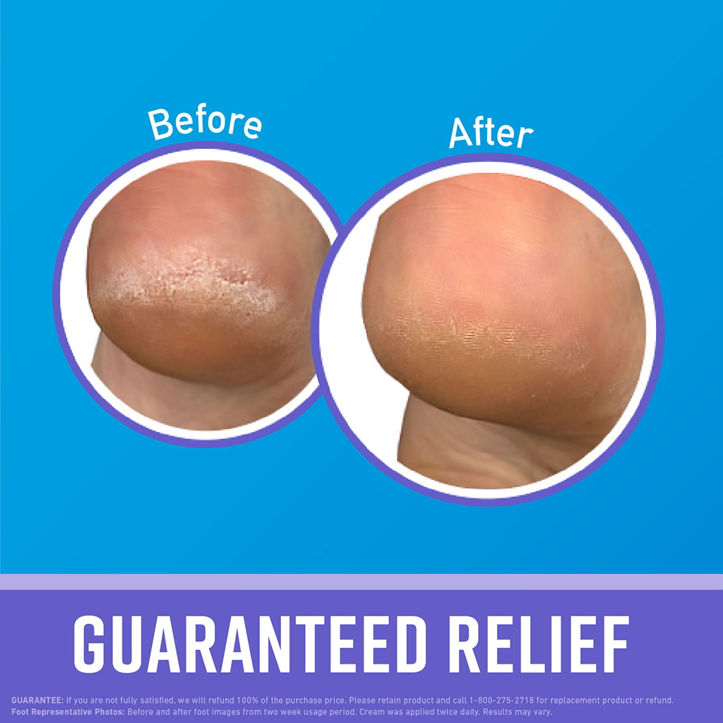 O'Keeffe's, Healthy Feet Foot Night Treatment Cream, Intensive overnight foot repair and hydration, 89ml