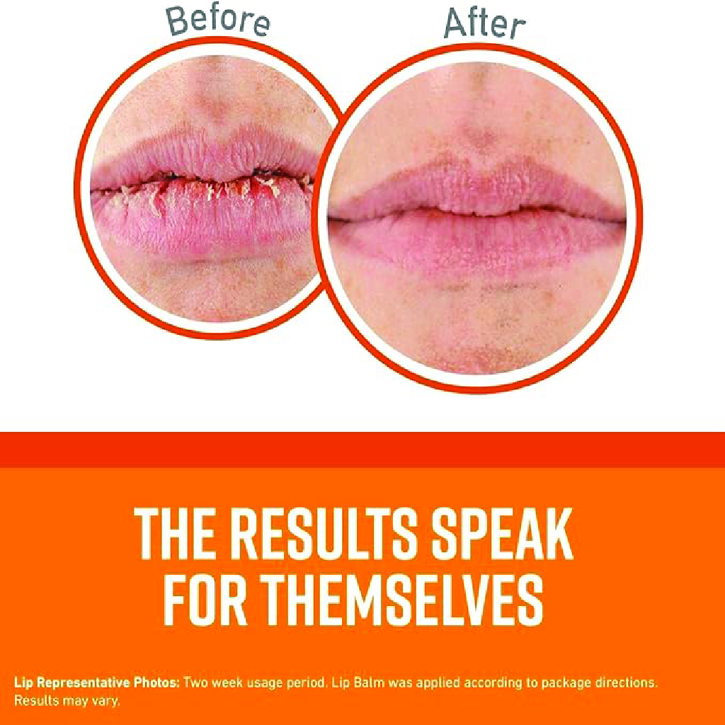 O'Keeffe's, Lip Repair Stick Unscented, Intensive moisturizing lip balm for dry cracked lips, 4 g