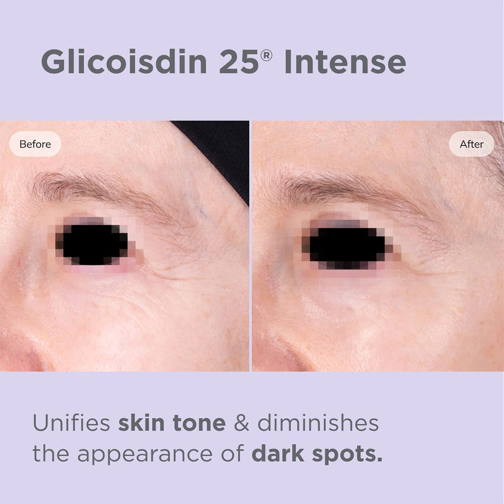 Isdin, Isdinceutics Glicoisdin 25 Intense Facial Gel, Exfoliating Facial Gel with Glycolic Acid, 50g
